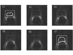 Inter-slice Bidirectional Registration-based Segmentation of the Prostate Gland in MR and CT Image Sequences